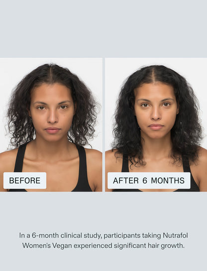 Women’s Hair Support Supplement for Fuller-Looking Hair