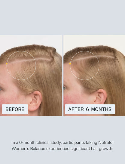 Women’s Hair Wellness Supplement for Thicker-Looking Hair